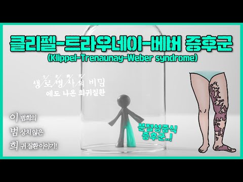 [월간 이.범.희] EP3. 한쪽 팔과 다리만 커지는 '클리펠-트레노네이-베버증후군(분절성증식증후군)'