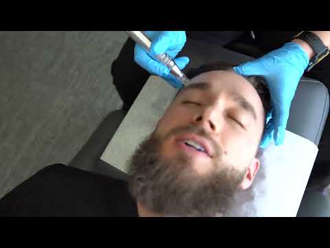 Microneedling Treatment Process w/ Dr. Sarah White | Denver | Pro Performance Chiropractic