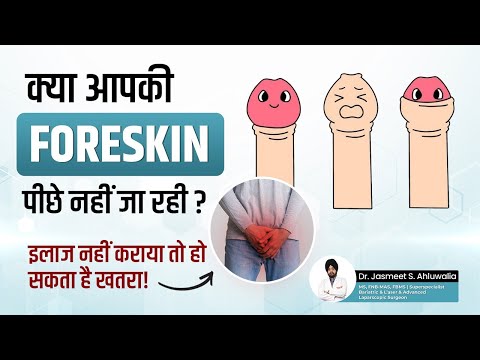 Phimosis in Hindi - Meaning, Causes, Symptoms, Risk& Treatments | Tight Foreskin Treatment in Males