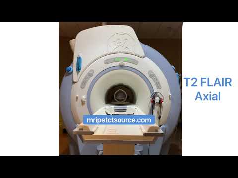 Specialized Brain MRI Scan Sounds Inside Scan for Brain Shunt