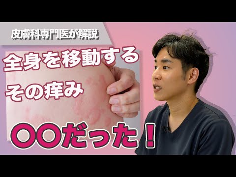 全身を移動するその痒み〇〇だった！