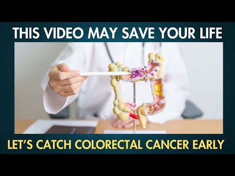 11 Early Signs of Colorectal Cancer that you SHOULDN’T IGNORE