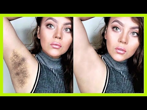 DIY Hair Removal Cream| Unwanted Facial Hair Removal