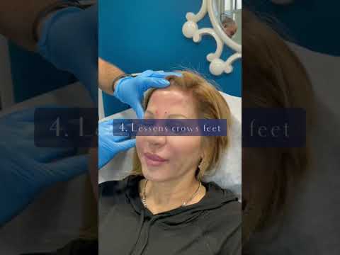 6 Incredible Benefits of Botox You Need to Know | Quick & Effective Treatment, Plantation #shorts