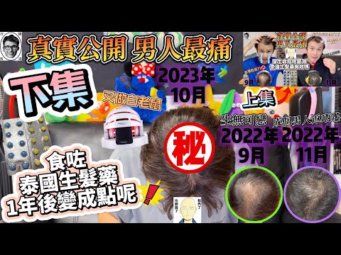 [痴線實測] 下集 泰國生髮藥有效嗎❓影響性能力❓👨🏻‍🦲壓力？｜脫髮問題 脫髮危機 ｜男人最痛｜絕非廣告 真實用家分享｜真人實測｜實驗影片｜挑戰任務crazy man｜CurrentBody