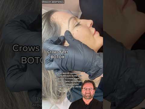 Botox for Crows Feet - Surgeon Reacts