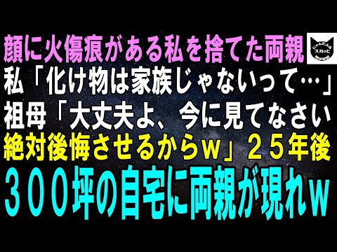 【スカッとする話】顔に火傷痕がある私を捨てた両親。私「化け物は家族じゃないって…」祖母「なに、今に見てなさいｗあいつら後悔させてやるわｗ」２０年後、私が住む300坪の自宅に両親が現れ…ｗ【修羅場】