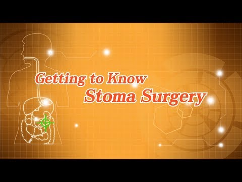 Getting to Know Stoma Surgery