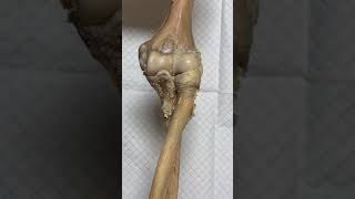 Elbow Joint