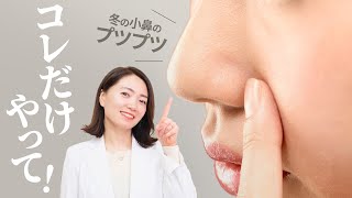 冬の「小鼻の白いブツブツ」これでOK