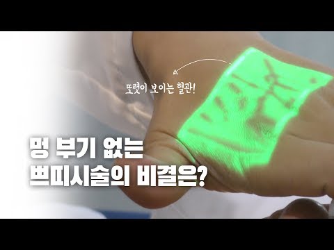 “봉봉 쁘띠성형 멍, 부기 없는 진짜 이유는?”