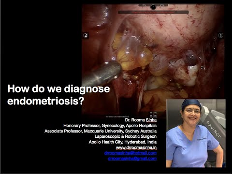 How do we diagnose Endometriosis? Dr Rooma Sinha Apollo Hospitals Hyderabad; www.drroomasinha.in