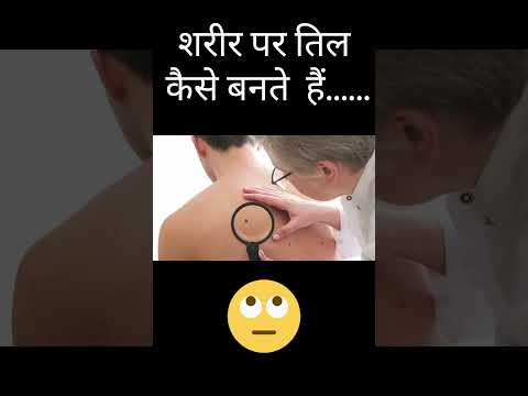 Know the correct reason,why we get moles on body....👀🤔🤔