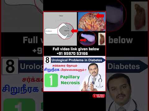 1. Papillary Necrosis - Diabetes and Kidney diseases /சர்க்கரை நோயும் 8 சிறுநீரக பிரச்சனைகளும்