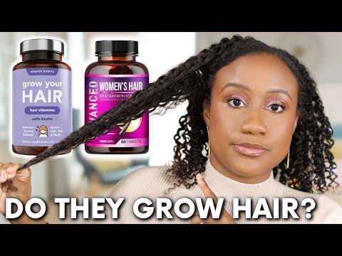 Do Hair Growth Vitamins Work Or Are They A SCAM? | Watch Before Buying Hair Growth Supplements