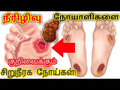 நீரிழிவு நோயாளிகளை குறிவைக்கும் சிறுநீரக நோய்கள்/Kidney Diseases Targeting Diabetics/STAR LABORATORY