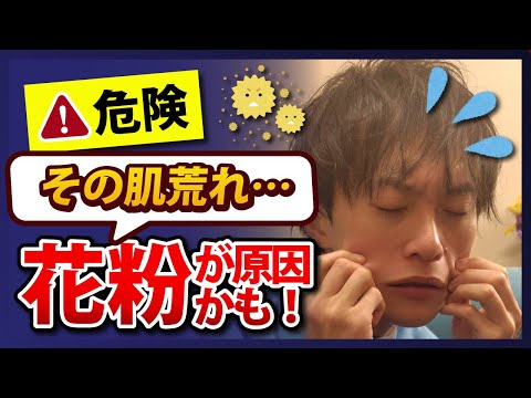 【花粉皮膚炎について薬剤師が徹底解説いたします❗️】