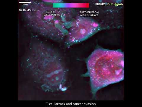 T cell attack and cancer evasion