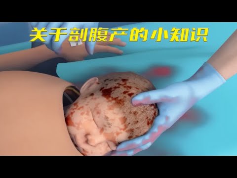 你知道剖腹产是如何进行的吗？看完视频后让你震惊不已