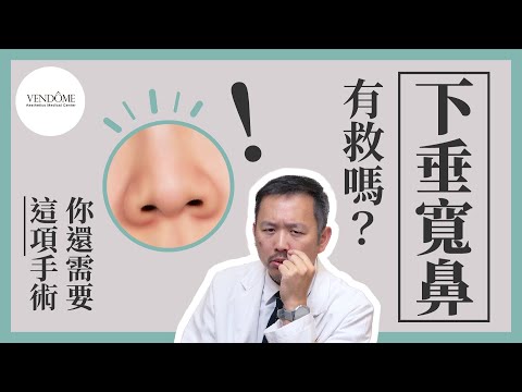 下垂寬鼻做縮鼻還不夠？這項手術拯救你的鼻翼下垂！【鼻翼拉提（上）】｜凡登整形外科 林彥斌醫師