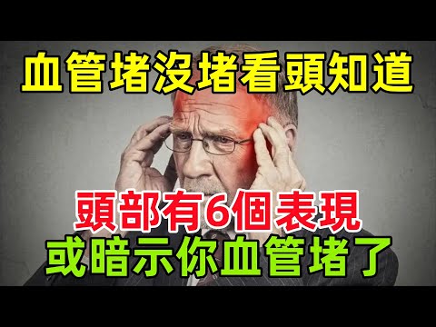 血管堵沒堵，看頭就知道？頭部若有這6個表現，或暗示你血管堵了#健康常識#養生保健#健康#健康飲食