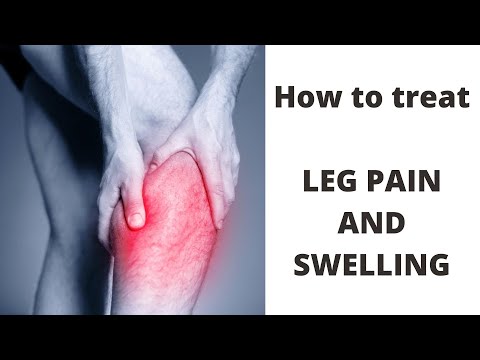 Treatment for Leg Pain and Swelling