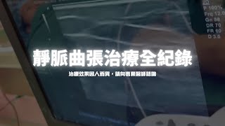 靜脈曲張治療全紀錄（六步驟）-極緻美型·文心極緻美型皮膚科診所整形手術-林子鈞醫師：靜脈曲張_台中靜脈曲張_硬化劑_雷射治療_注射治療