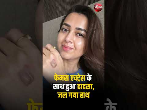 Famous TV Actress Tejasswi Prakash के साथ हुआ हादसा, जल गया हाथ