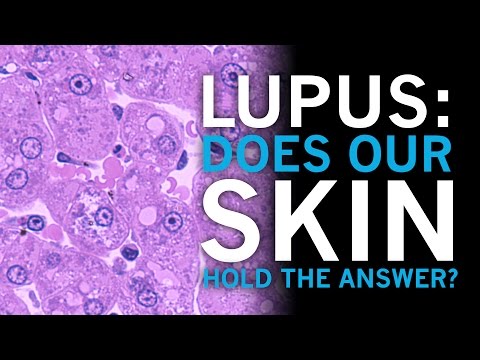 Lupus | Does our skin hold the answer?