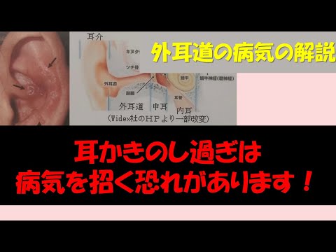 外耳道の疾患について徹底解説【現役医師が解説！】