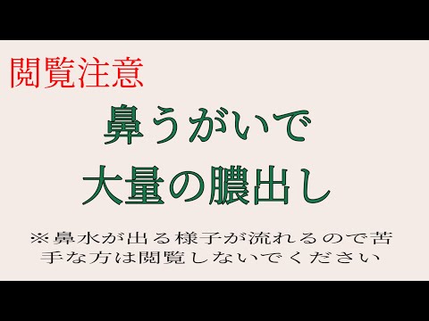 【閲覧注意】急性副鼻腔炎で鼻うがいをしたら、緑色のドロッとした膿が大量に出てきました