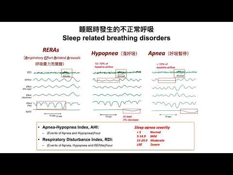 20230313 生物感測器與實務 生理監測臨床應用評估 1