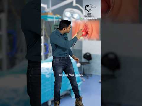 பெண்ணுறுப்பின் உதடுகளுக்குள் கட்டி/ Bartholin cyst- Dr. Isacc Abbas