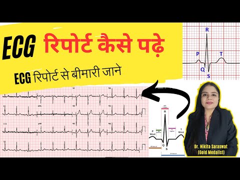 How to read ECG REPORT | ECG Report kaise Pade | ECG report Doctor Hospital | Nursing | BHMS | BAMS