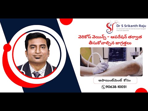 వెరికోస్ వెయిన్స్ - ఆపరేషన్ తర్వాత తీసుకోవాల్సిన జాగ్రత్తలు | డా.శ్రీకాంత్ రాజు | వాస్కులర్ సర్జన్