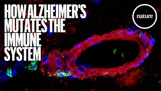 How Alzheimer's mutates the immune system