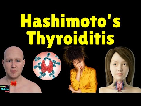 Hashimoto's Disease (Hashimoto's Thyroiditis) – Causes, Symptoms, Diagnosis and Treatment