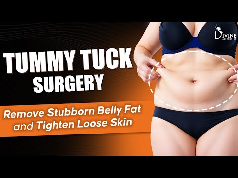 Tummy Tuck Surgery: Remove Stubborn Belly Fat and Tighten Loose Skin