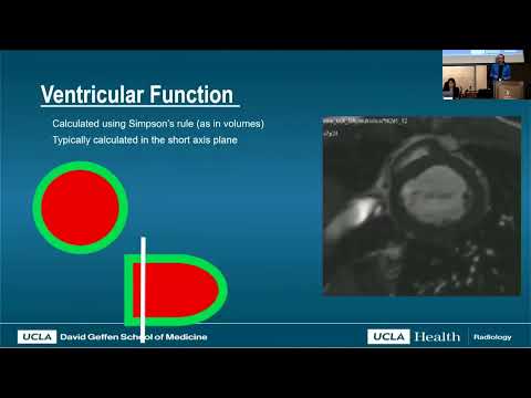 Advanced Imaging of the Adult Fontan Patient - Ashley Prosper, MD