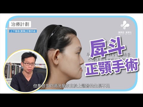 【科普一下】姜厚任醫師｜正顎手術如何治療戽斗？