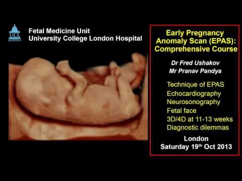 Anomaly Scan at 11-13 weeks: ISUOG 2013 approved course