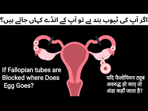 Pregnancy & Blocked fallopian tube | Egg Kaha Jaye ga agr tubes band ha Tu? Reason for blocked tubes