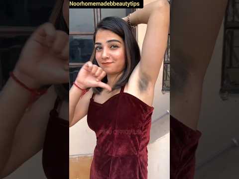 Get Rid Of Dark Underarms | How To Get Fair Underarms | Remove Underarms Darkness #shorts #viral