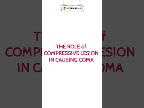 Mechanisms of Coma by Compressive Lesions #shorts #shortvideo