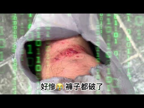 20240907越野受傷紀錄 offroad Injury record video