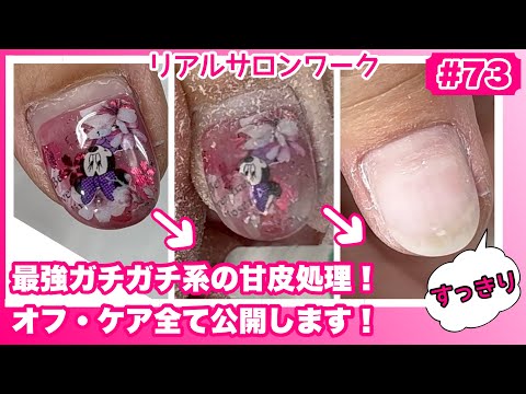 【#73】甘皮ごっそり‼️ガッチガチ系の甘皮処理❤️ジェルネイルオフ・マシーンケア・フィルイン/リアルサロンワーク公開‼️