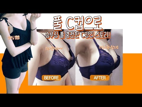 봉봉성형외과에서 하이브리드 가슴성형으로 풀C컵이 되어  슴부심 풀충전한 C양의 리얼스토리!