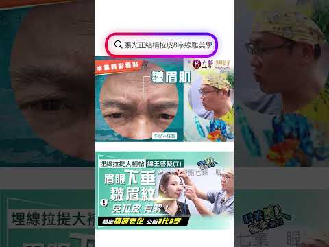 埋線拉提大補帖｜線王答疑(7)眉眼下垂、額頭鬆弛 誰說只能前額拉皮手術？　線雕拉提3代8字就能搞定！ 一次同步解放緊鎖皺眉紋 科普醫美新知364-20241018