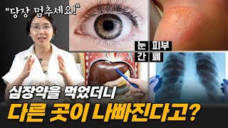 반드시 먹어야 하는 부정맥약 부작용💊 | 서울아산병원 차명진 교수