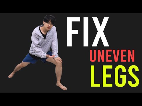 Fix Uneven Legs｜Leg Discrepancy｜Corrective Exercises